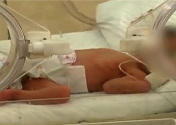لە ماوەی مانگێك 145 منداڵ به‌ ناكامى لە دایكبوونە