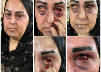 ئافرەتێک لەلایەن کوڕەکەی و ماڵی خەزوورانی ئەشکەنجە دەدرێت
