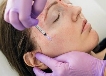 چارەسەری پلازما (PRP) چییە؟