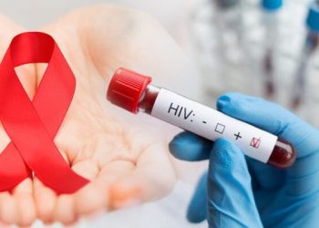 لە كۆی 538 هەزار پشكنین 54 حالەتی ئایدز تۆمار كراوە