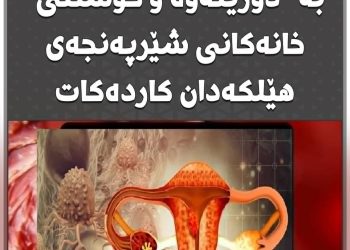 شیكردنەوەی دەرمانێك كە بە “دۆزینەوە و كوشتنی” خانەكانی شێرپەنجەی هێلكەدان كاردەكات
