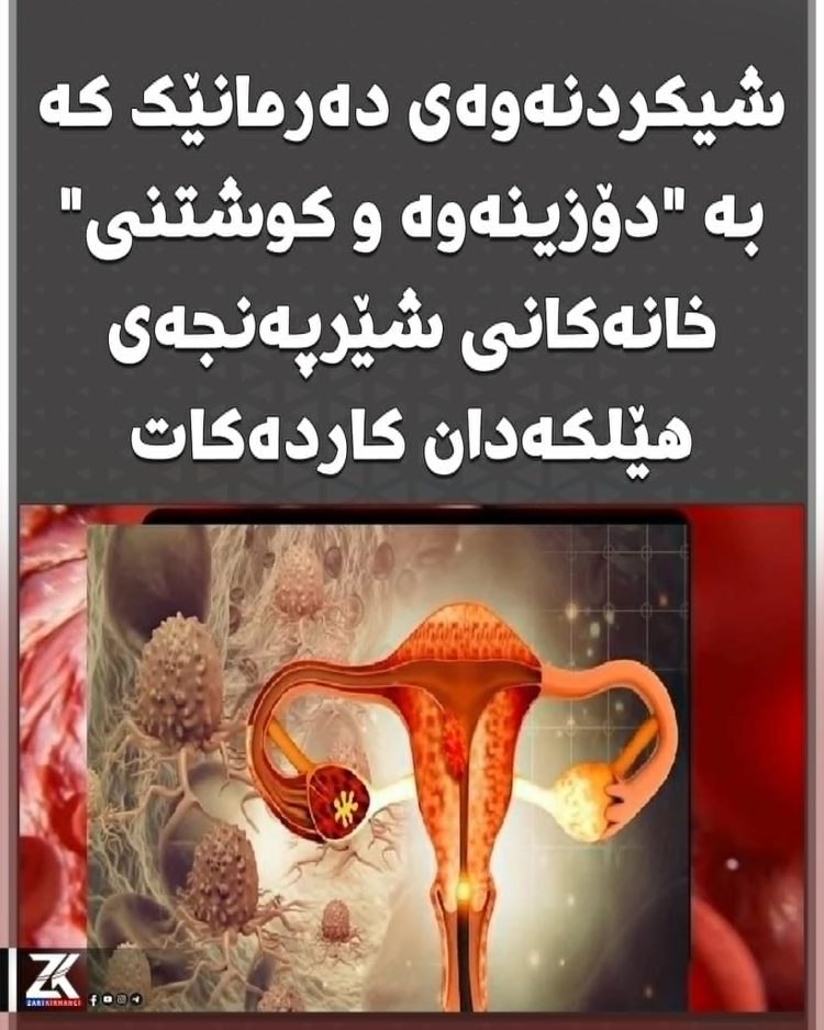شیكردنەوەی دەرمانێك كە بە “دۆزینەوە و كوشتنی” خانەكانی شێرپەنجەی هێلكەدان كاردەكات