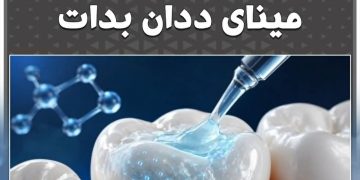 جێلێكی نوێ دەتوانێت یارمەتی چاككردنەوەی مینای ددان بدات