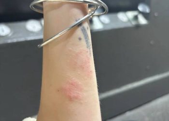 بۆچی زۆرێک لە ئافرەتان هەستیاریان بە بابەتە جوانکاریەکانەوە هەیە