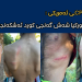 رێكخراوی CPTـی ئەمریكی : سەربازانی توركیا شەش گەنجی كورد ئەشكەنجە دەده‌ن