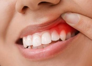 ئەم جۆرە لە هەو كردنی ددان مەترسیدارە و هەند وەری بگرن
