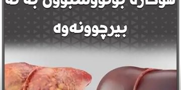 توێژینەوەیەك : چەوریی سەر ئەندامەكان هۆكارە بۆتووشبوون بە لەبیرچوونەوە