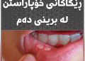 هۆكارە باوەكان و ڕێگاكانی خۆپاراستن لە برینی دەم